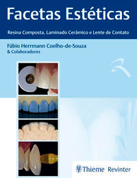 Facetas Estéticas