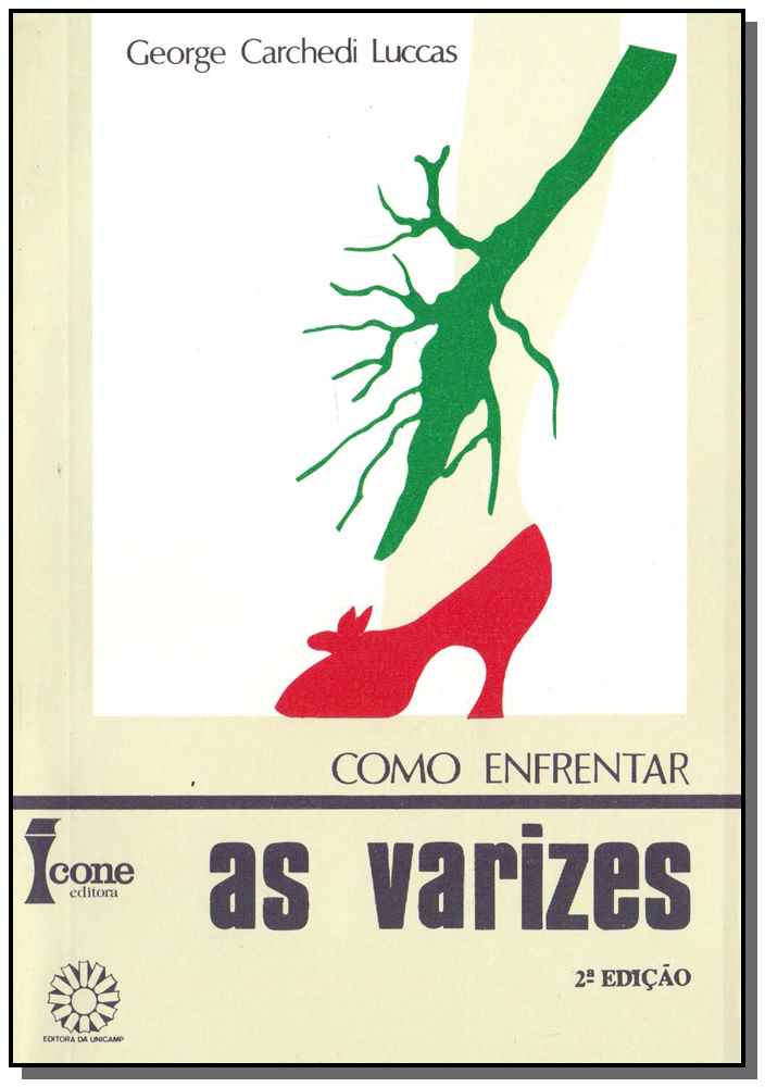 Varizes, as