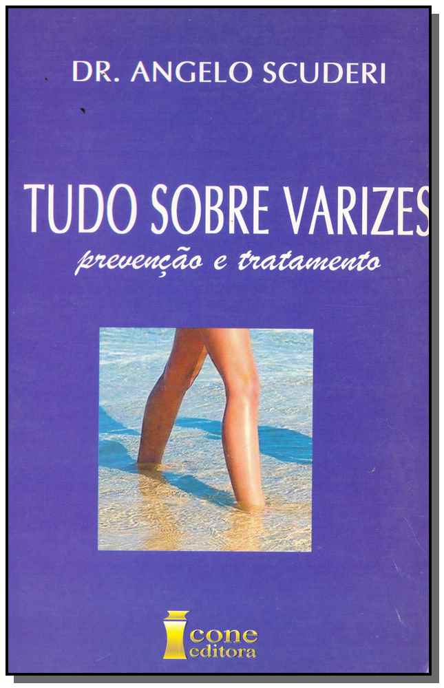 Tudo sobre Varizes - Prevenção e Tratamento