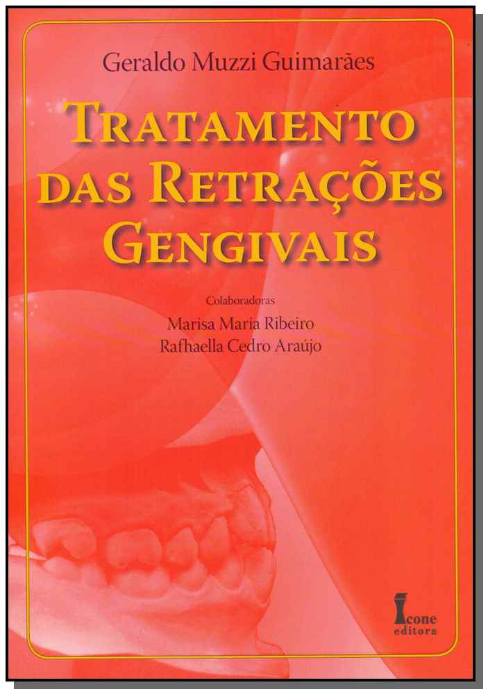 Tratamento das Retrações Gengivais
