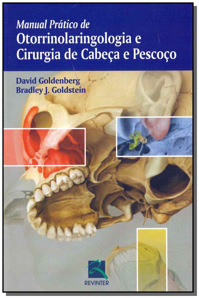Manual Prático de Otorrinolaringologia e Cirurgia de Cabeça e Pescoço