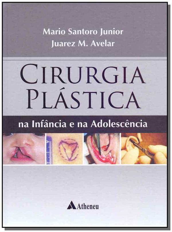 Capa do livro Cirurgia Plástica na Infância e na Adolescência - 01ed/18, de Mario Santoro Jr., Juarez Avelar