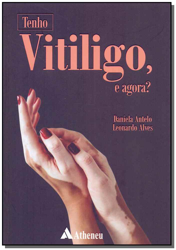 Tenho Vitiligo, e Agora?