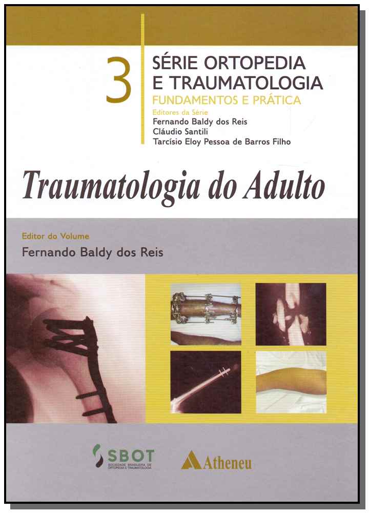 Traumatologia do Adulto - Vol. 03