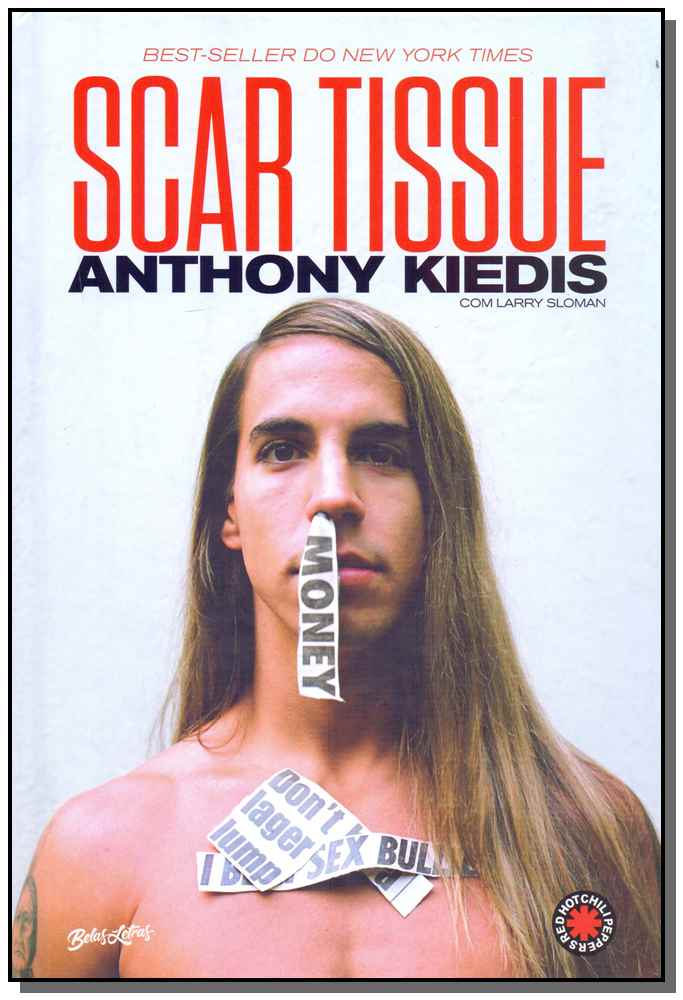 Scar Tissue