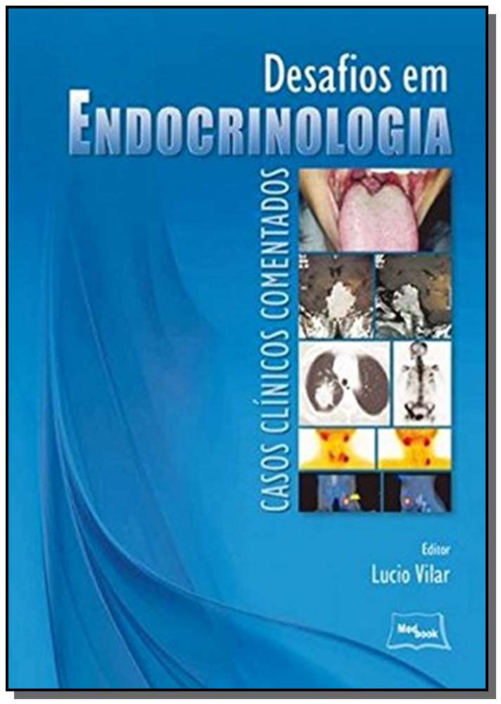 Desafios em Endocrinologia - Casos Clínicos Coment