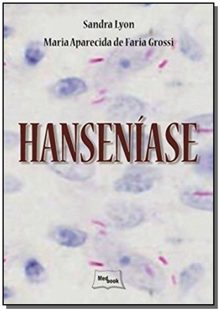 Hanseníase